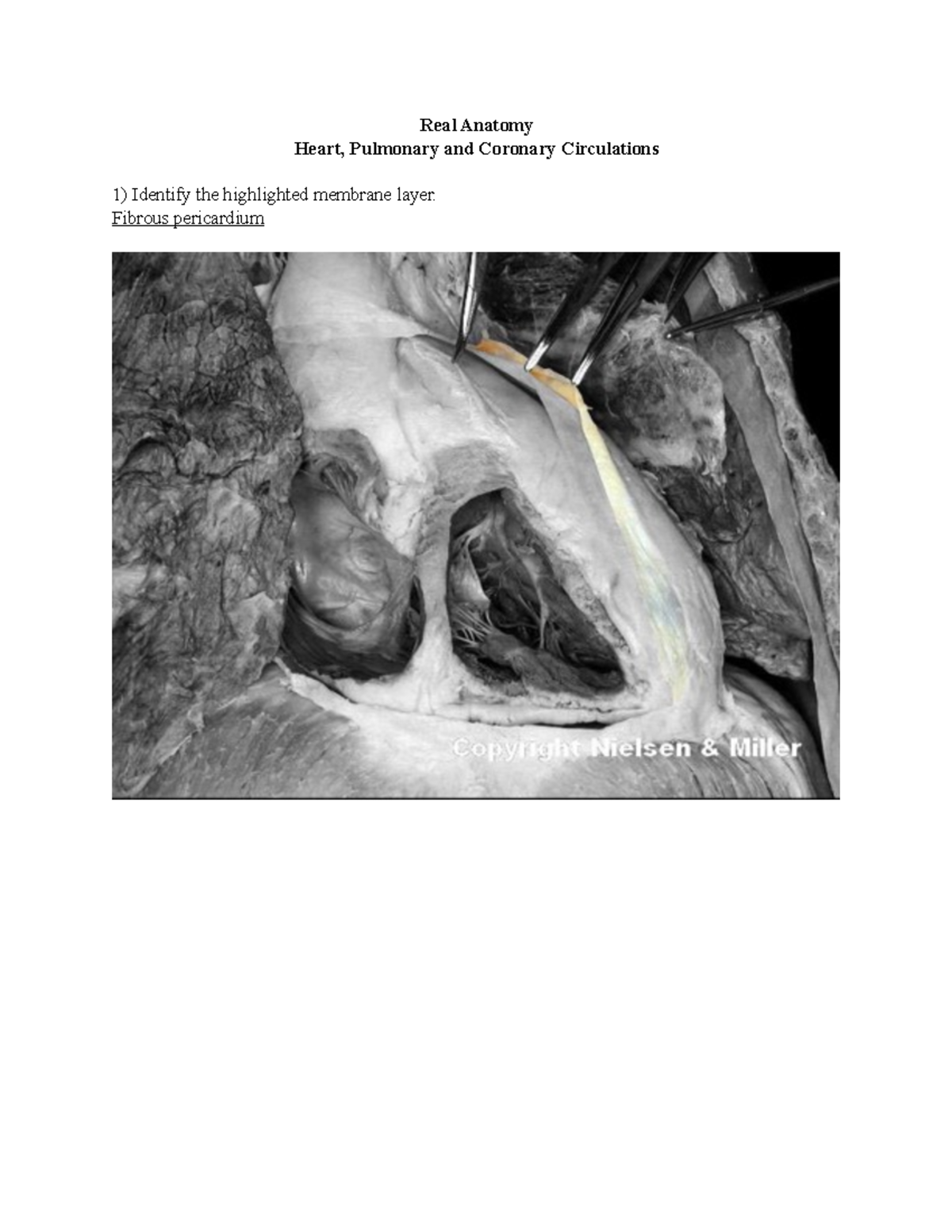 38 heart pulmonary and coronary circulations Answer Key - Real Anatomy ...