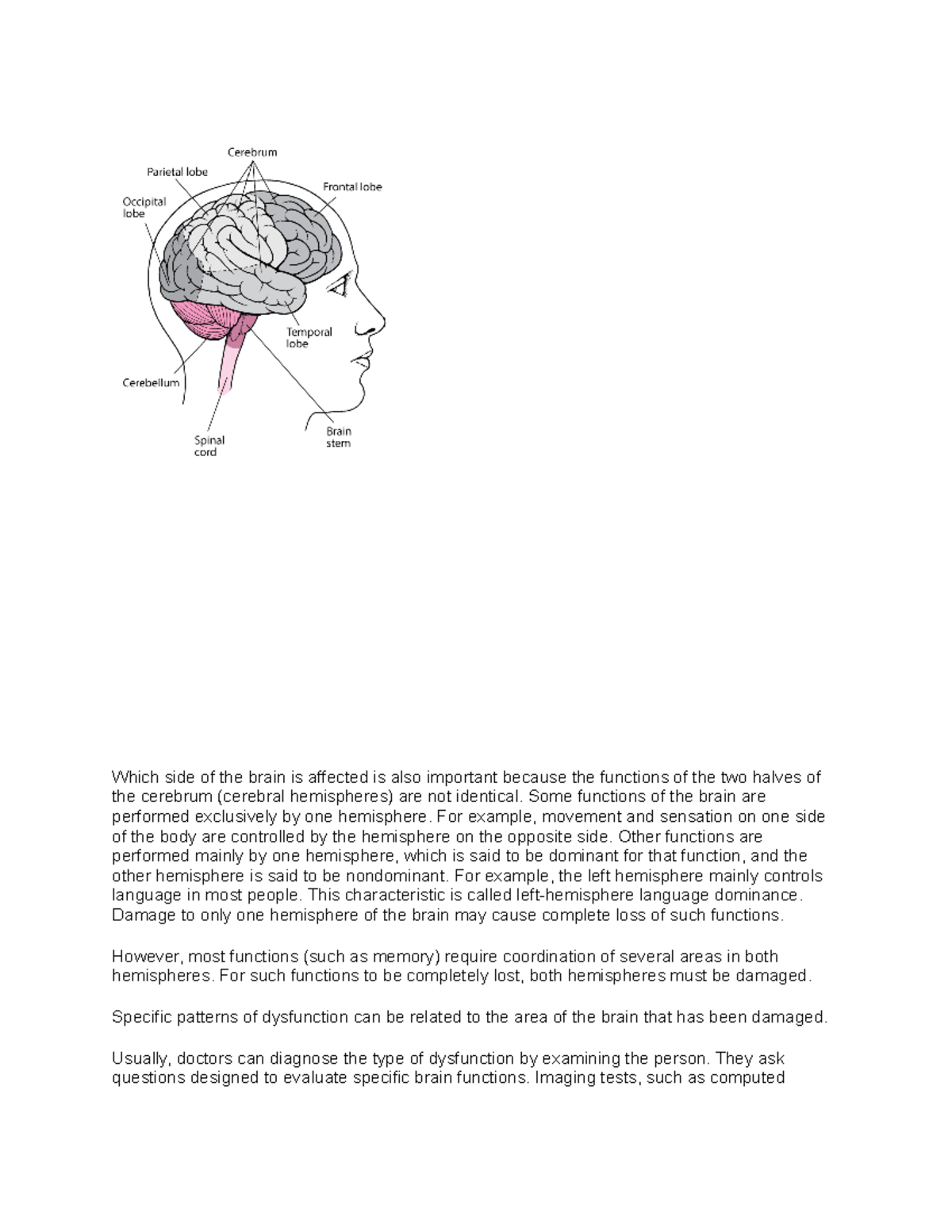 the-brain-notes-which-side-of-the-brain-is-affected-is-also-important