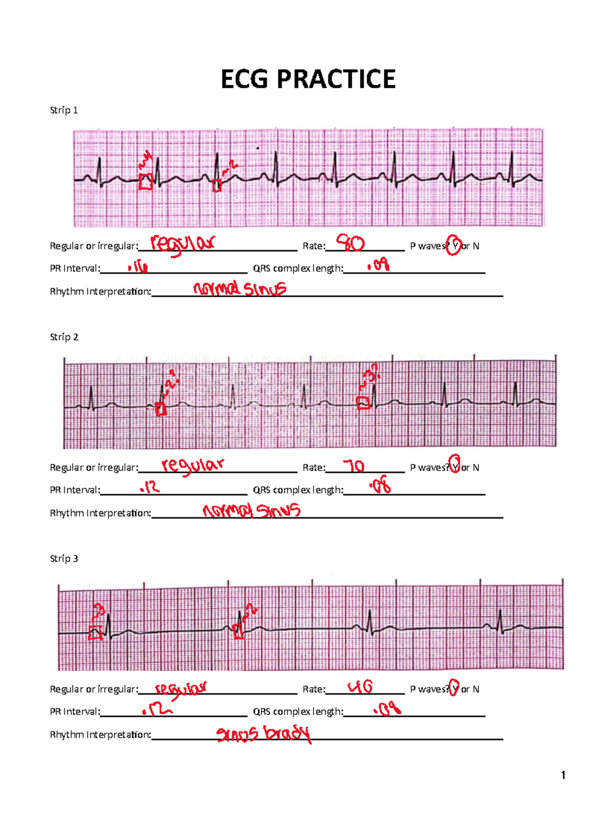 EKG Practice Handout - ECG PRACTICE Strip 1 Regular or irregular: Rate ...