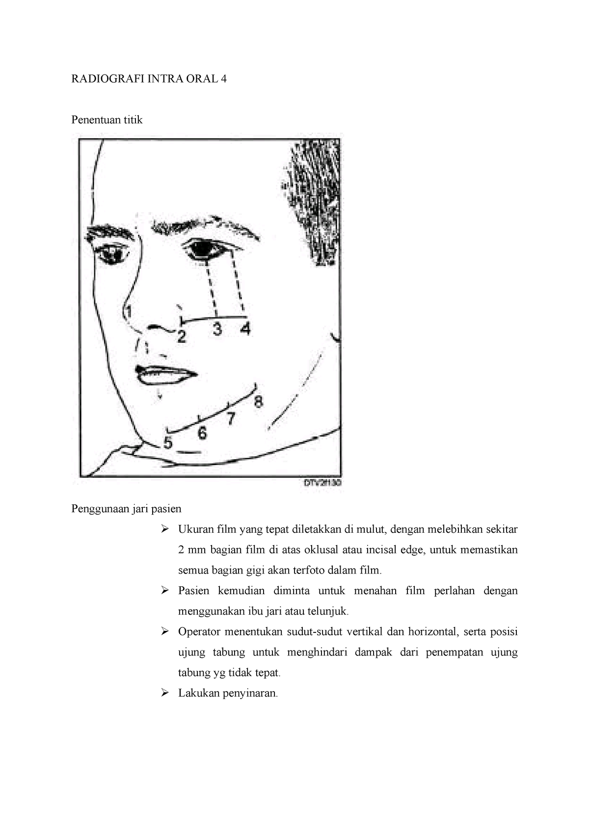 Radiografi Intra Oral 4 Radiografi Intra Oral 4 Penentuan Titik Penggunaan Jari Pasien Ø