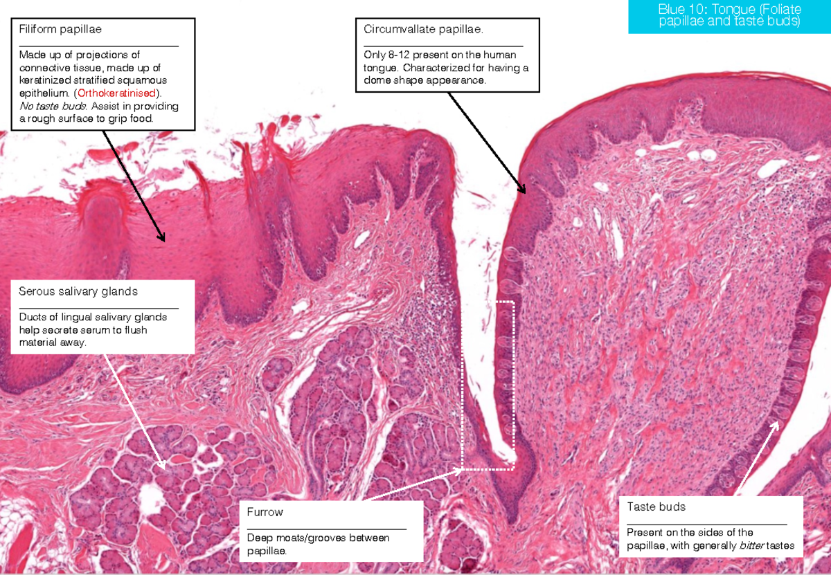 ANAT3009 Papillae - Blue 10: Tongue (Foliate papillae and taste buds ...
