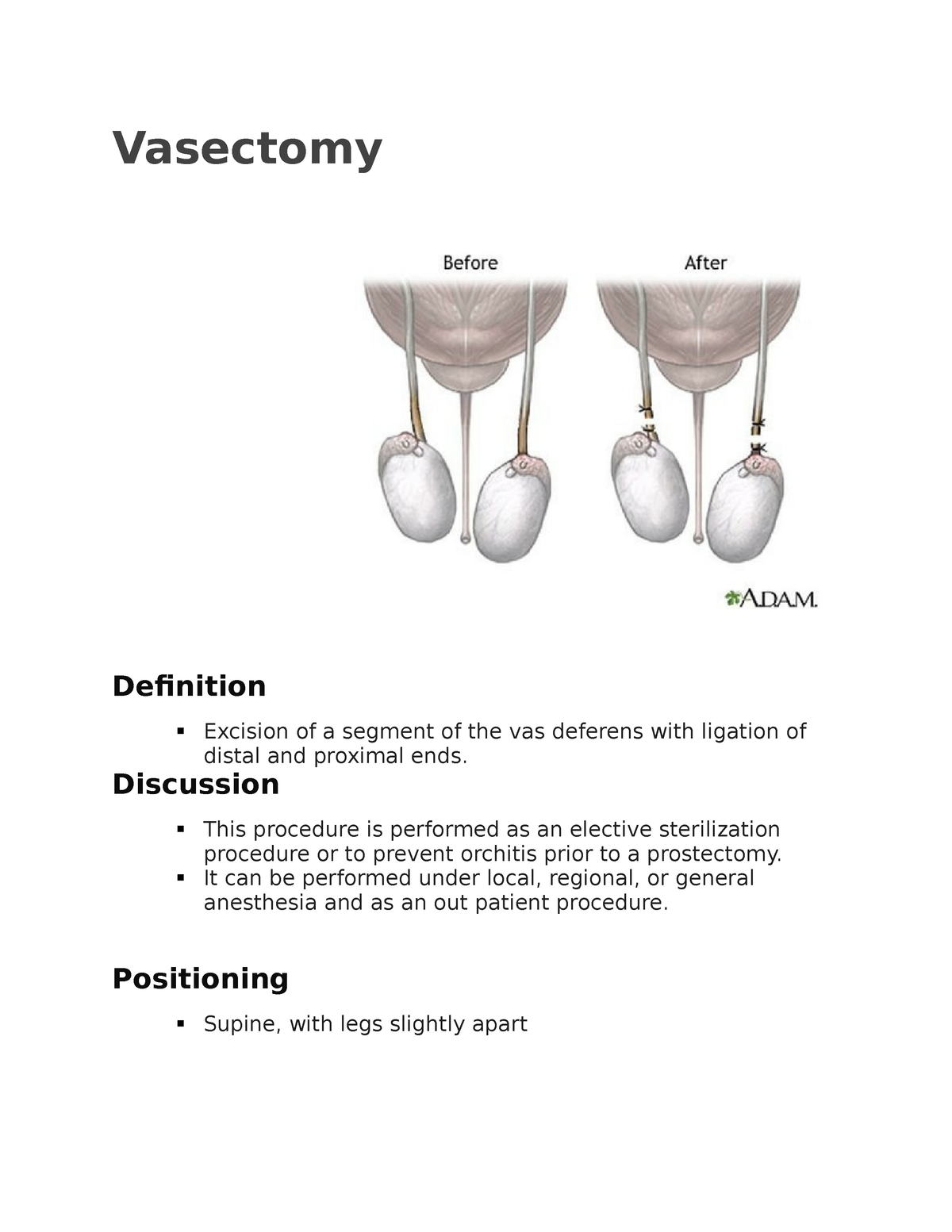 vas-nursing-management-vasectomy-definition-excision-of-a-segment