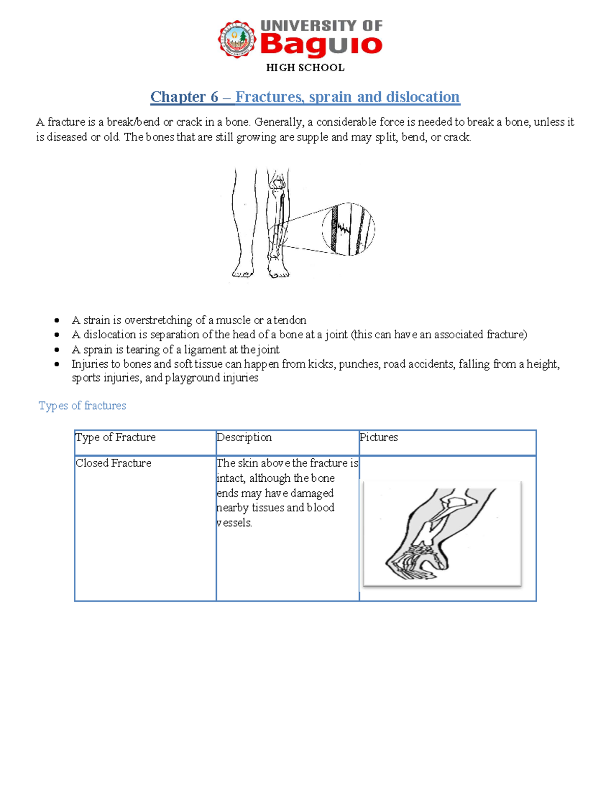 Physical Education Chapter6 Fractures Chapter 6 Fractures, sprain