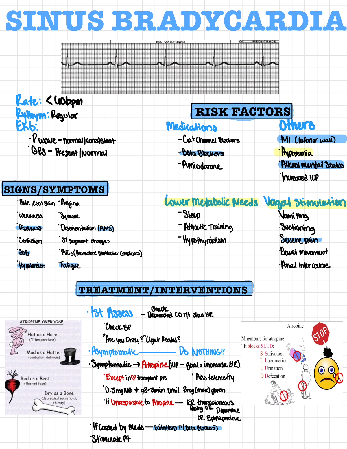 Dysrhythmias - heart dysrhythmia notes - SINUS BRADYCARDIA RISK FACTORS ...