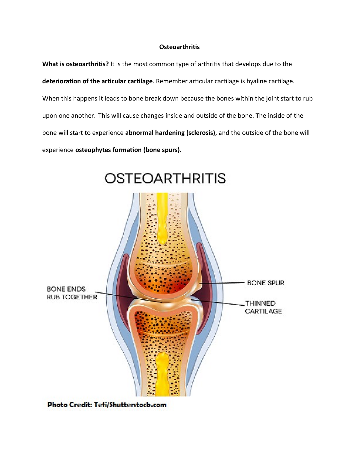 Osteoarthritis Nurn 222 Pediatric Nursing Concepts Ccbc Studocu