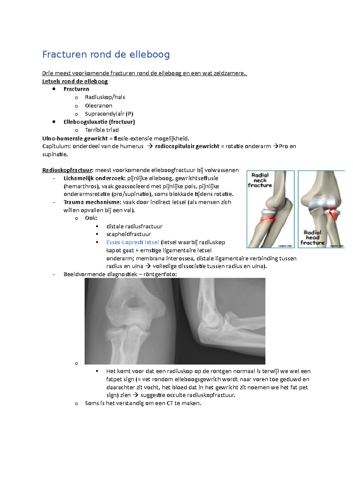 Aantekeningen HC Hand, Pols Elleboog - Fracturen Rond De Elleboog Drie ...