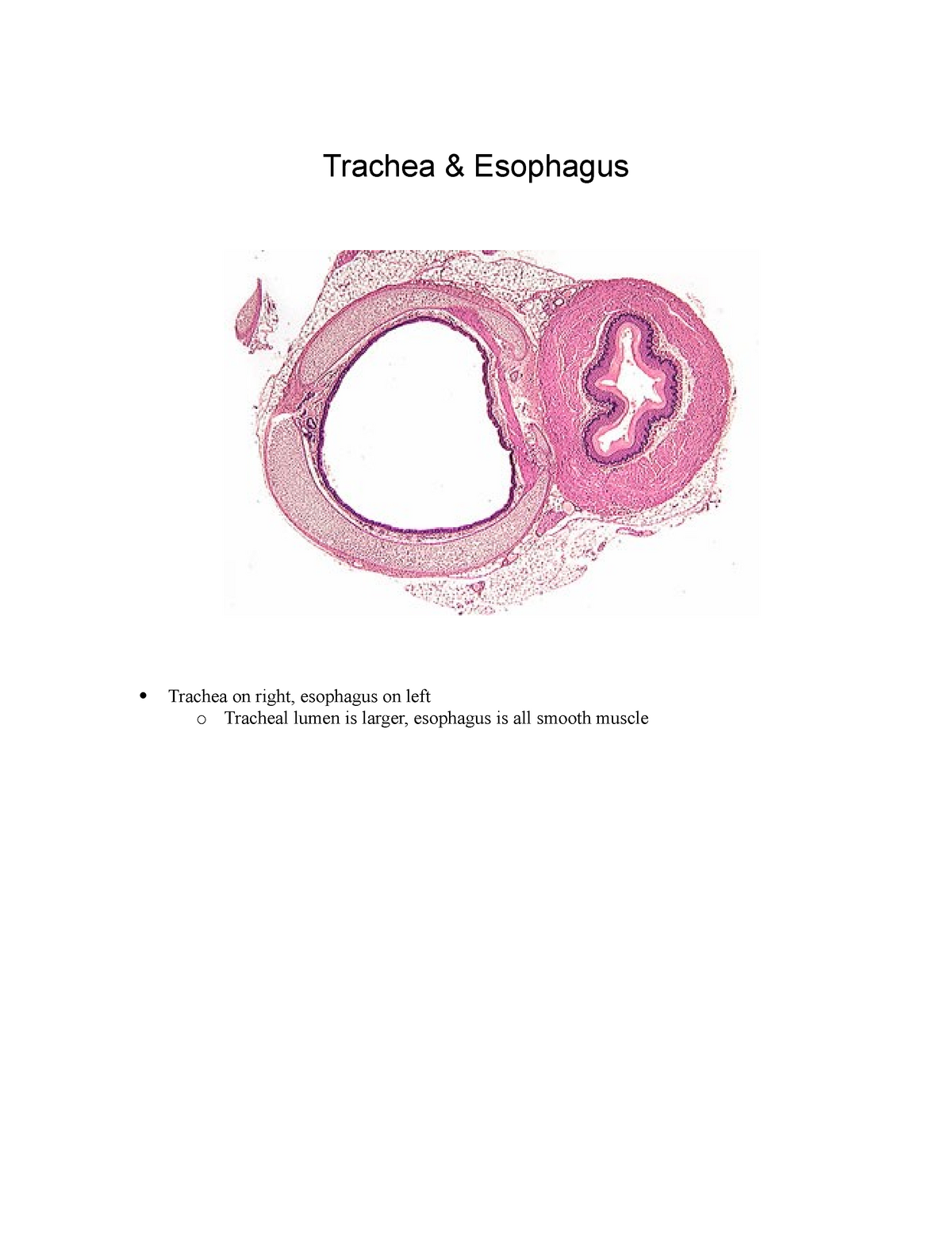 trachea histology diagram
