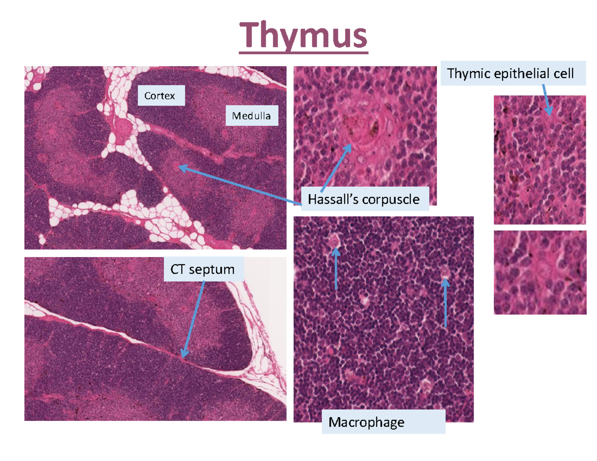 Lymphatics and Immune System - Example Images - Thymus Cortex Medulla ...