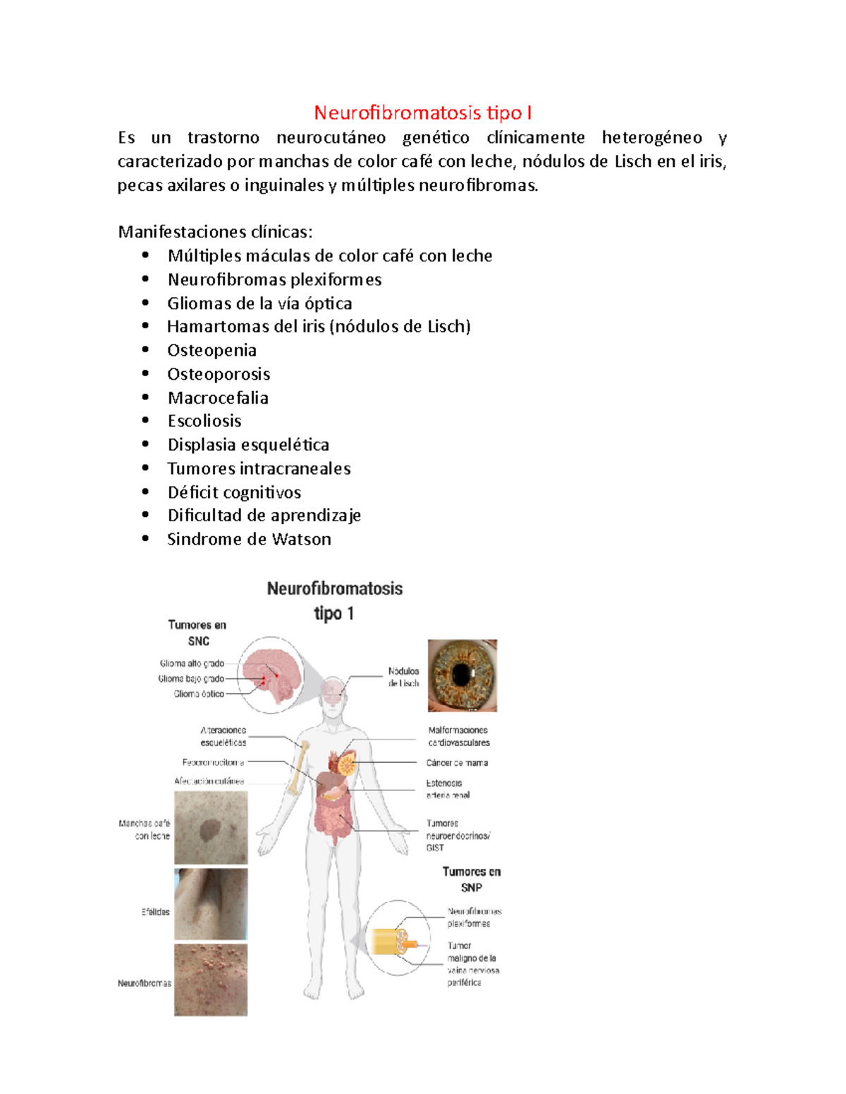 Neurofibromatosis - Manifestaciones clínicas: Múltiples máculas de ...