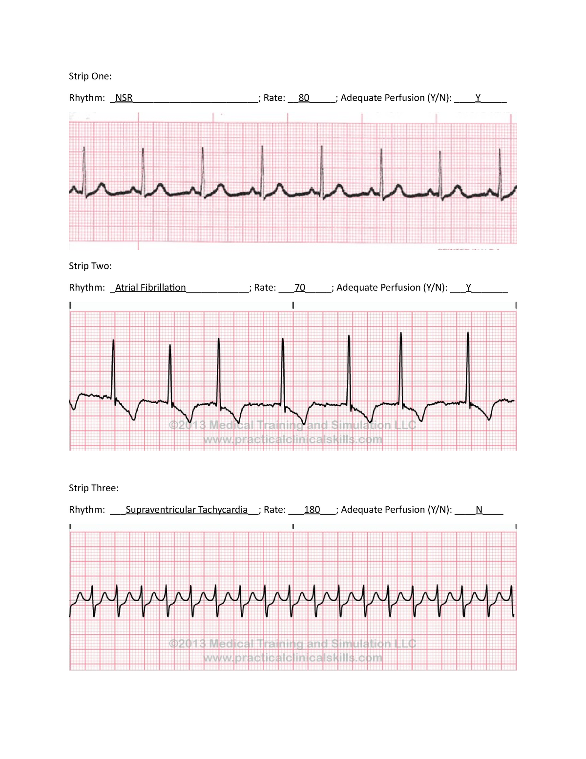 Strips for practice updated KEY - Strip One: Rhythm: NSR ...