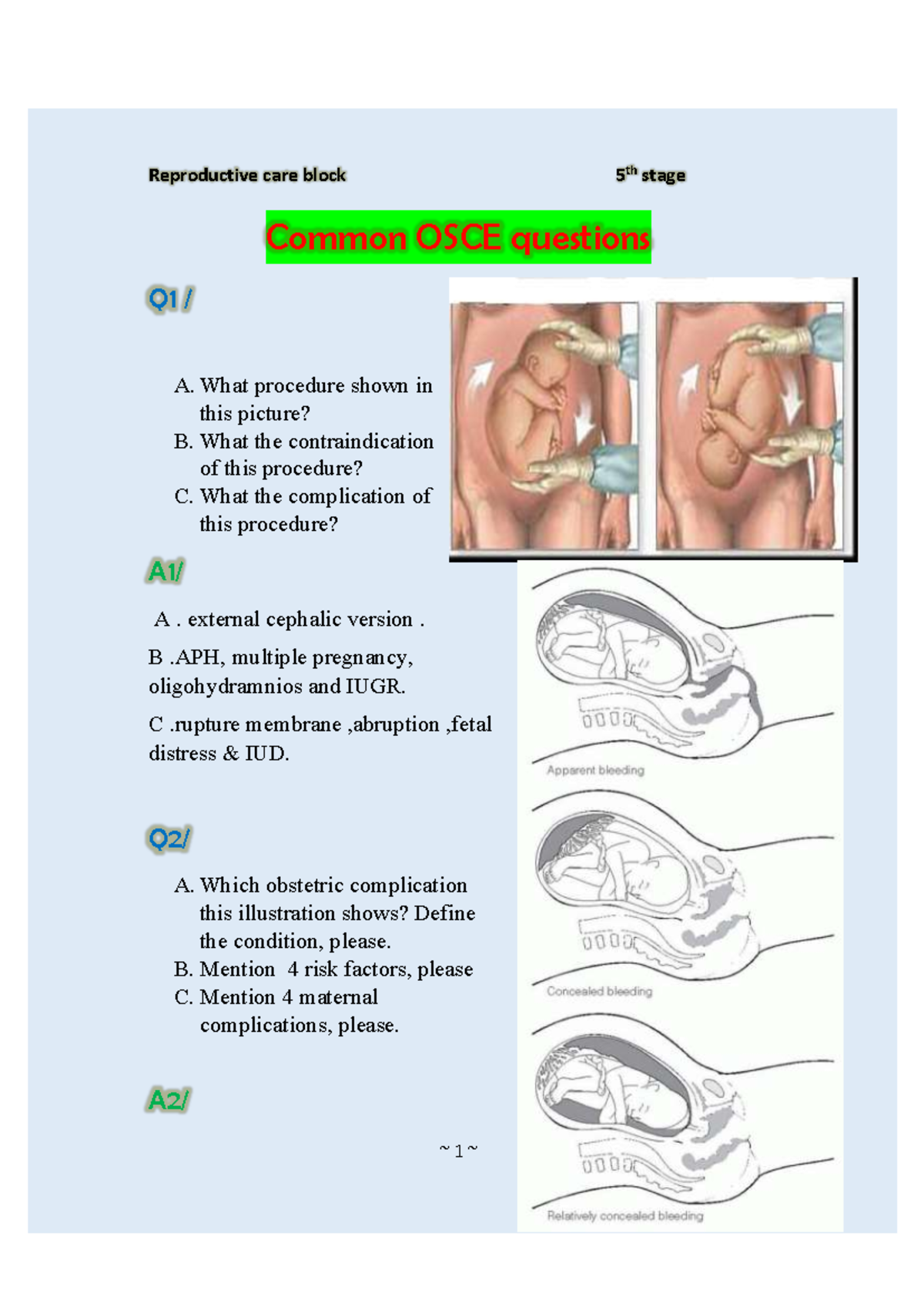 Screenshot 2023-09-30 at 4.13.22 PM - Common OSCE questions Q1 / A ...
