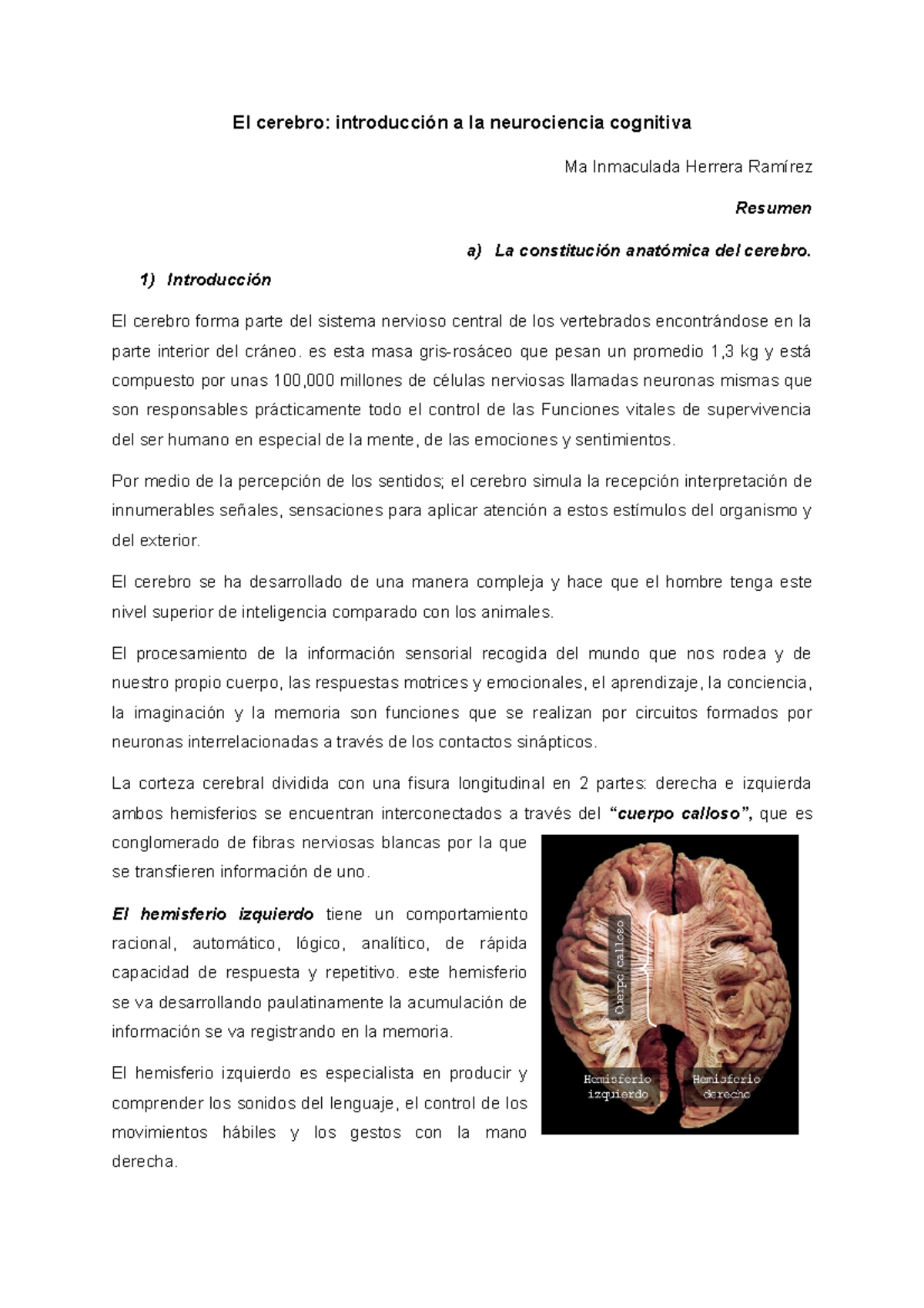 El cerebro ¿Cómo se construye el conocimiento científico? Thomas Kuhn tenía un planteamiento El cerebro ¿Cómo se construye el conocimiento científico? Thomas Kuhn tenía un planteamiento