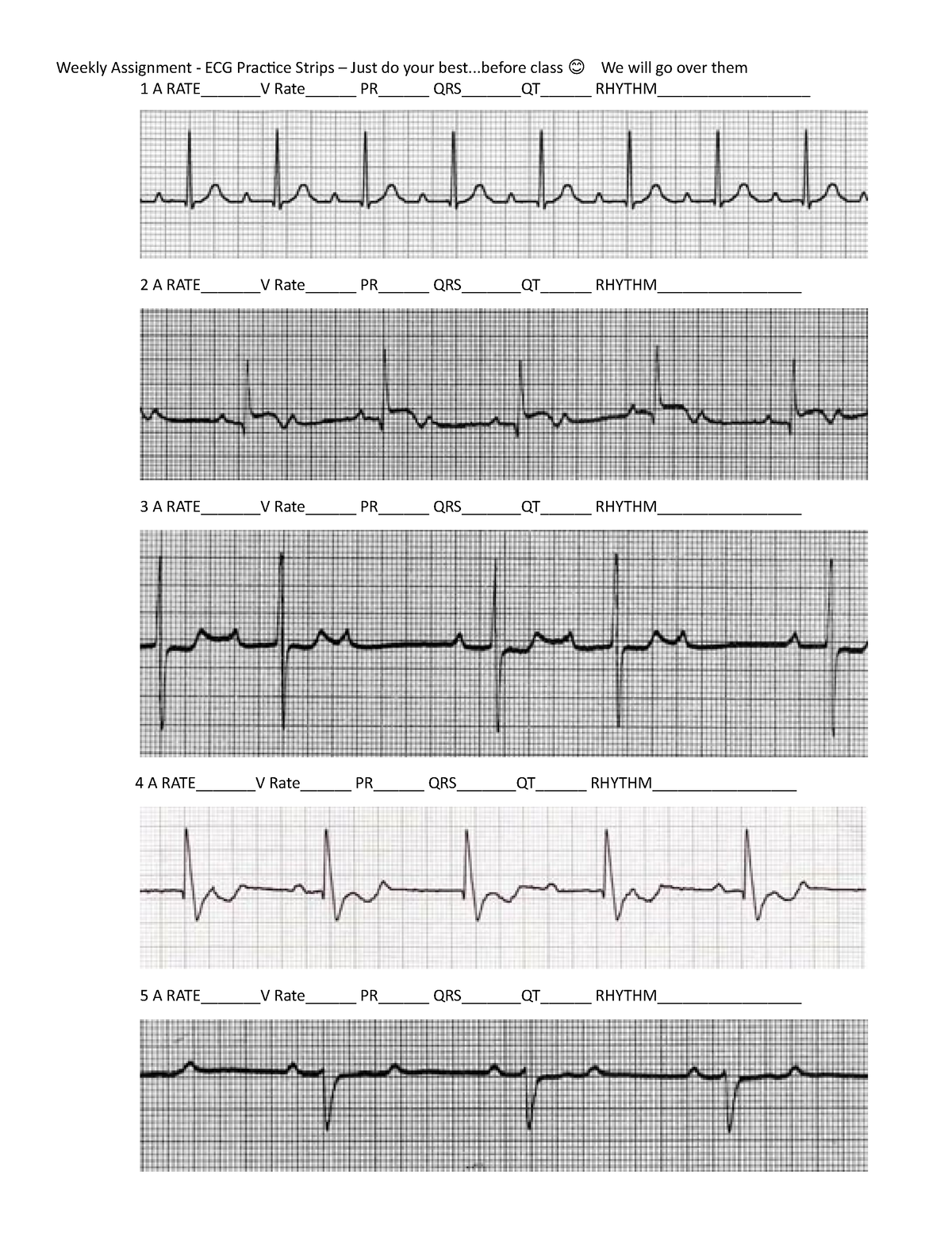 Weekly assignment - ECG Practice Strips - 1 A RATE_______V Rate ...