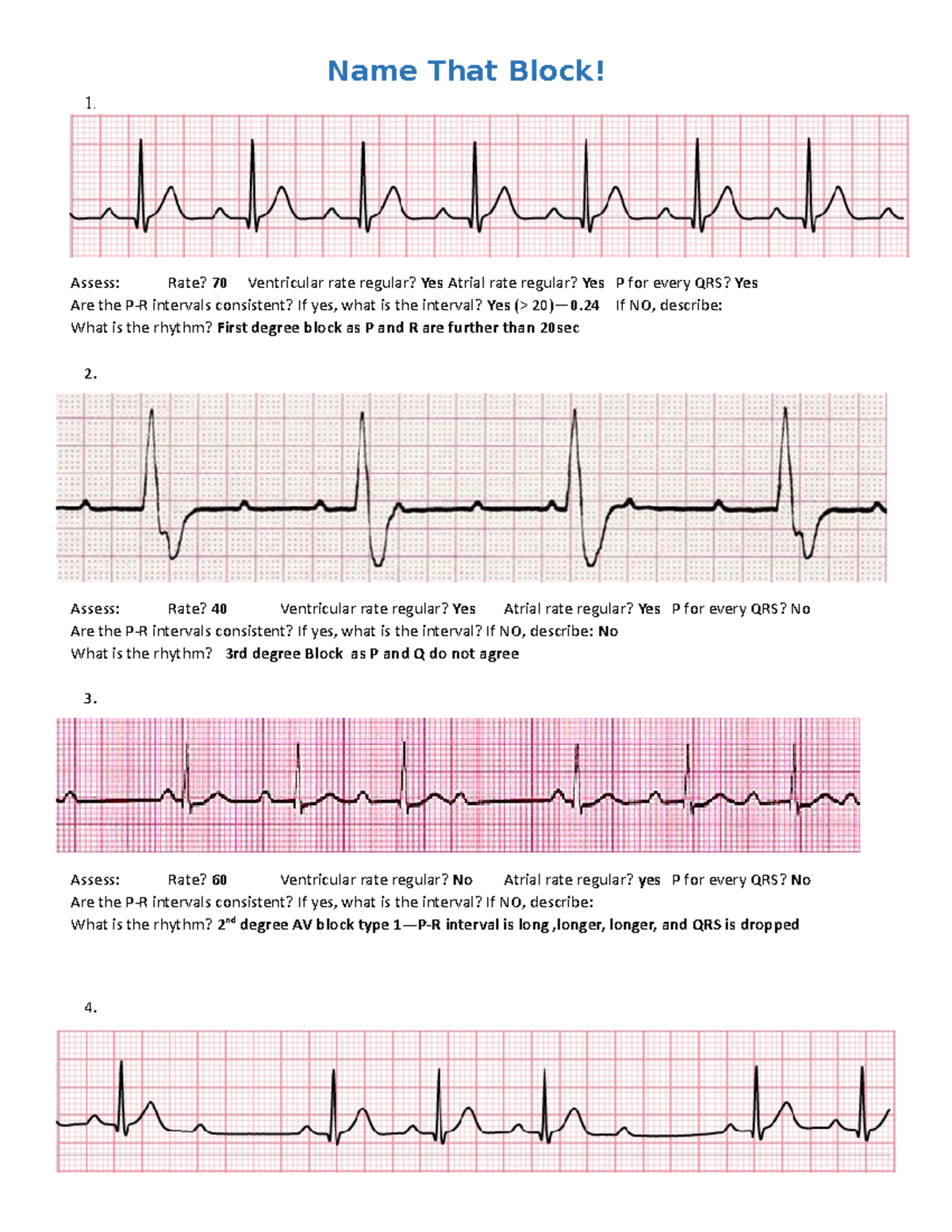 Answers-Pacemaker Name that Block Practice question 2020 - 1. Assess ...