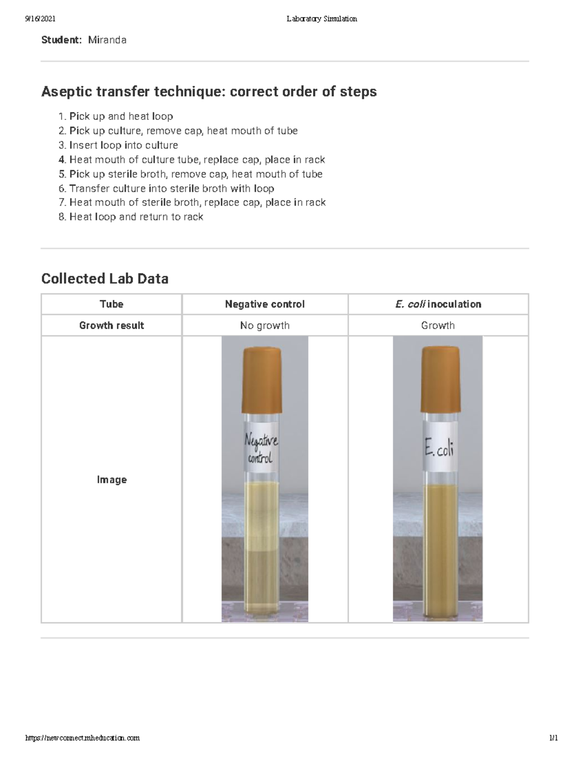 BLG 151 Lab 1 Module 2 Aseptic Technique Broth to broth