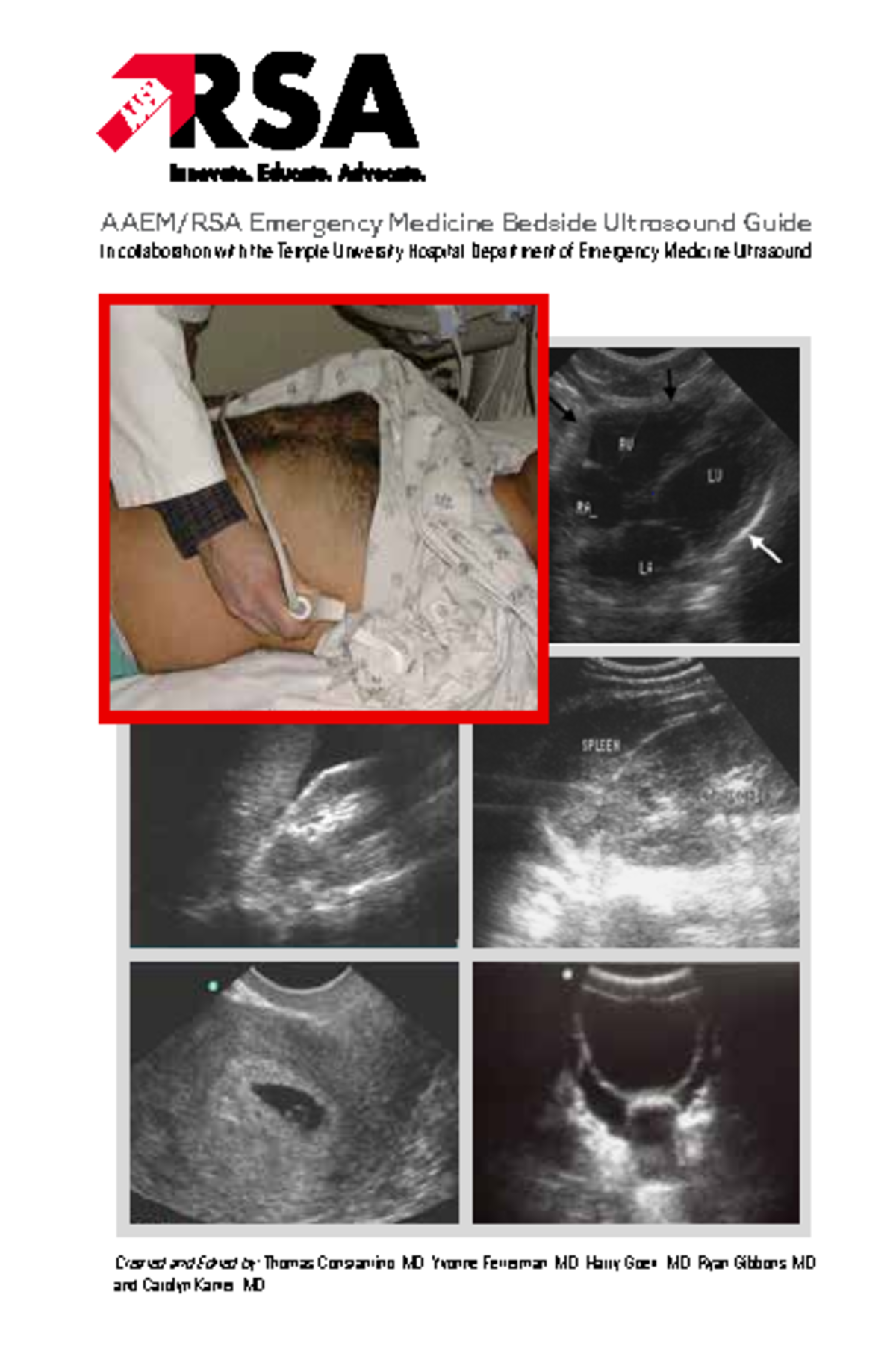 AAEM+RSA+Pocket+Guide - AAEM/RSA Emergency Medicine Ultrasound Guide ...
