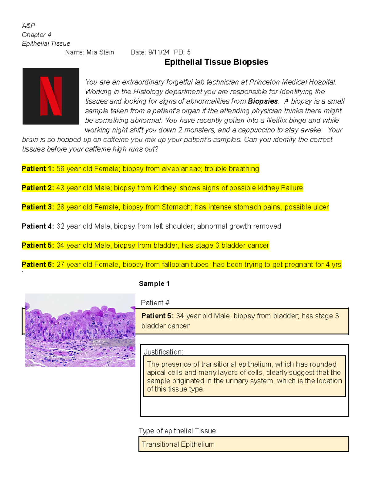 Epithelial Tissue Biopsy Mix Up A&P Chapter 4 Epithelial Tissue Name Mia Stein Date 9/11/24