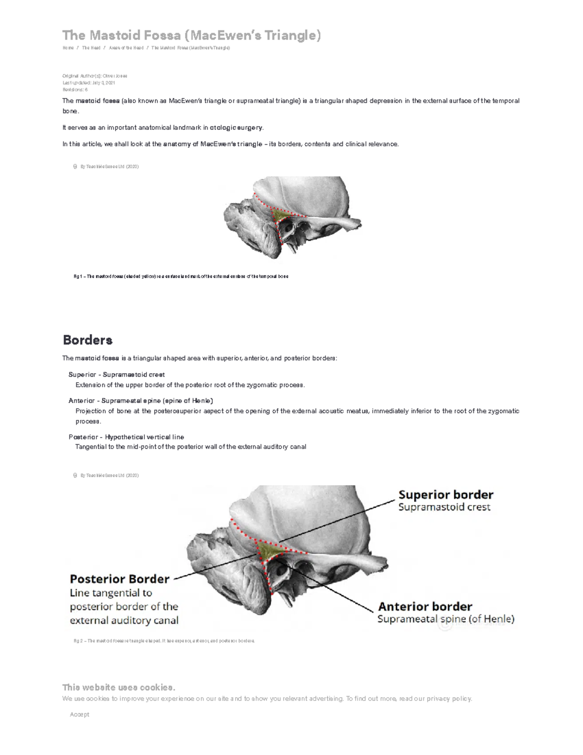 The Mastoid Fossa - Mac Ewen's Triangle - Borders - Contents - Teach Me ...