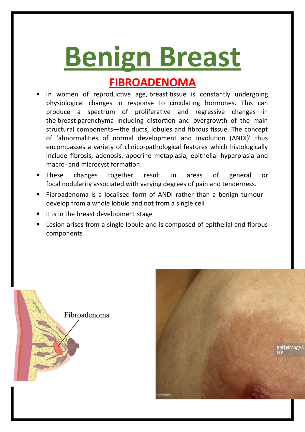 Benign Breast Conditions