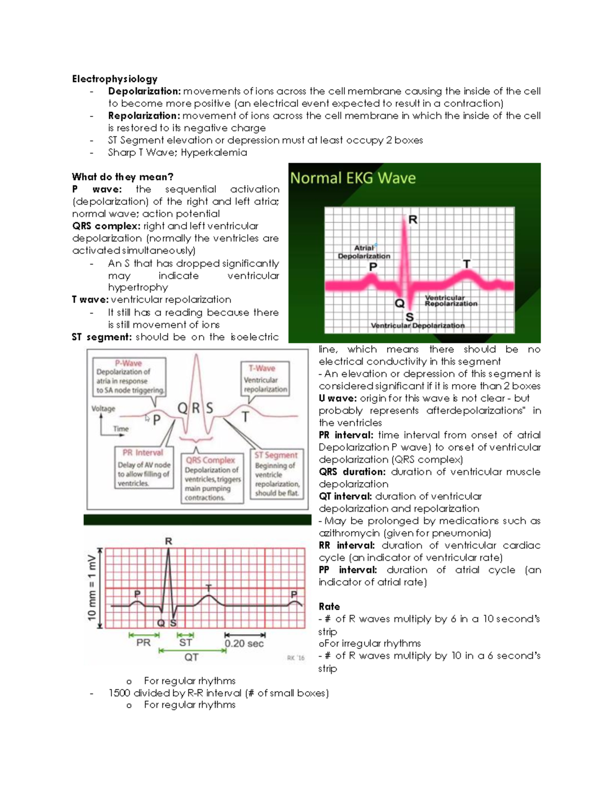 Electrophysiology - Sinus rhythm requires ALL of the following 3 ...