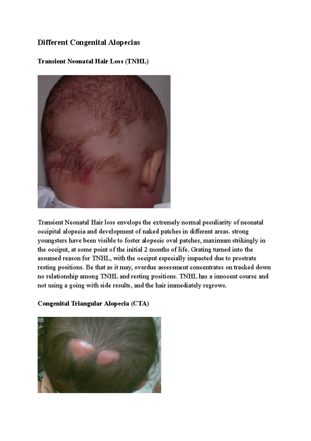 Different Congenital Alopecias Different Congenital Alopecias