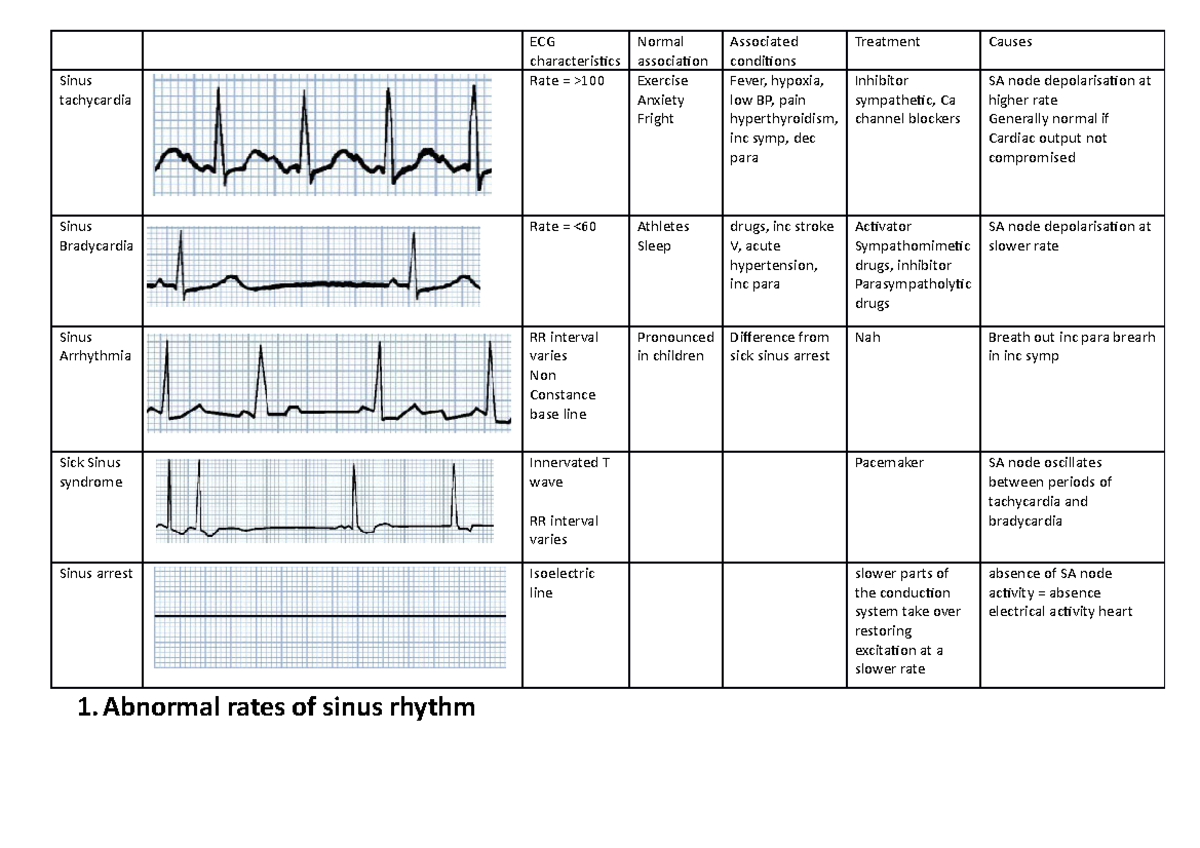 ECG characteristics - ECG characteristics Normal association Associated ...