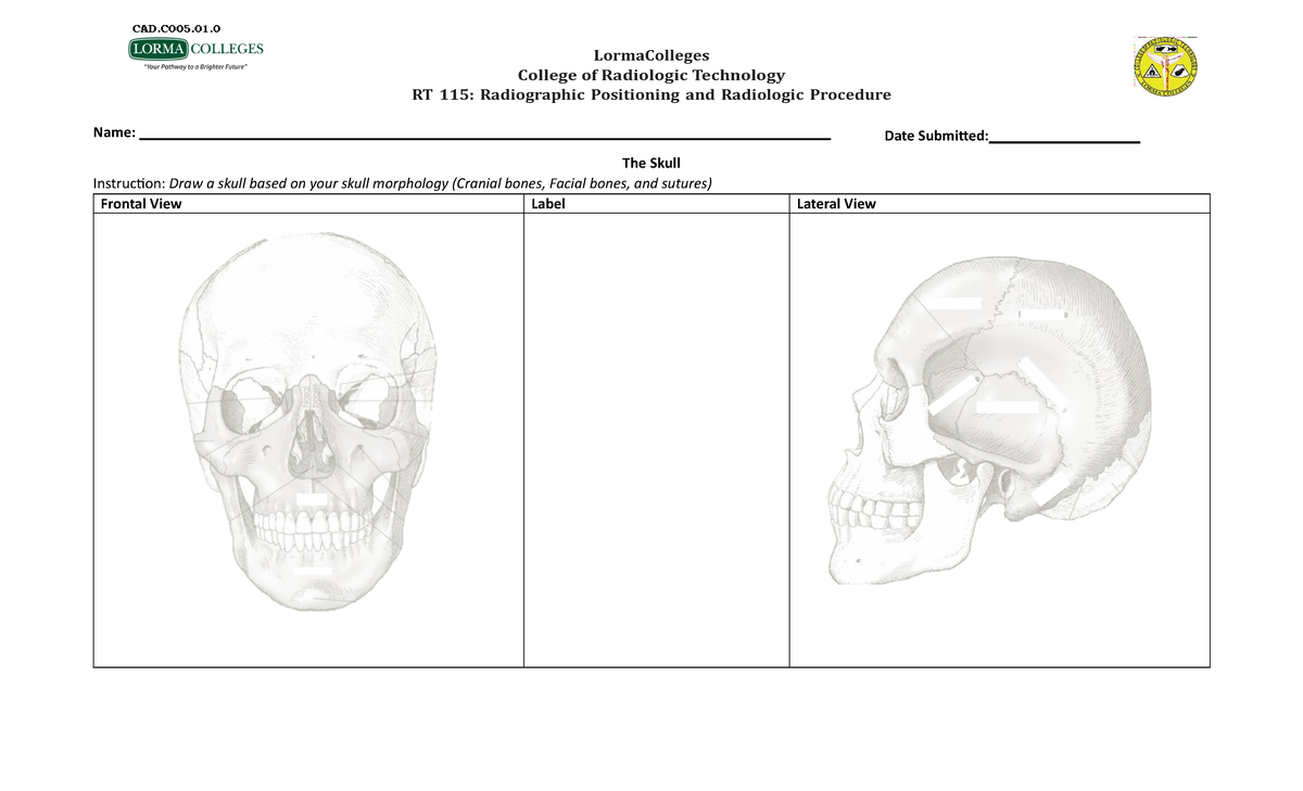 Drawing of the Skull - LormaColleges College of Radiologic Technology ...