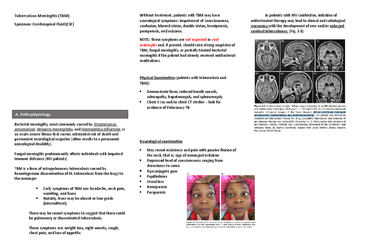 Tuberculous Meningitis Case Study - Tuberculous Meningitis (TBM ...