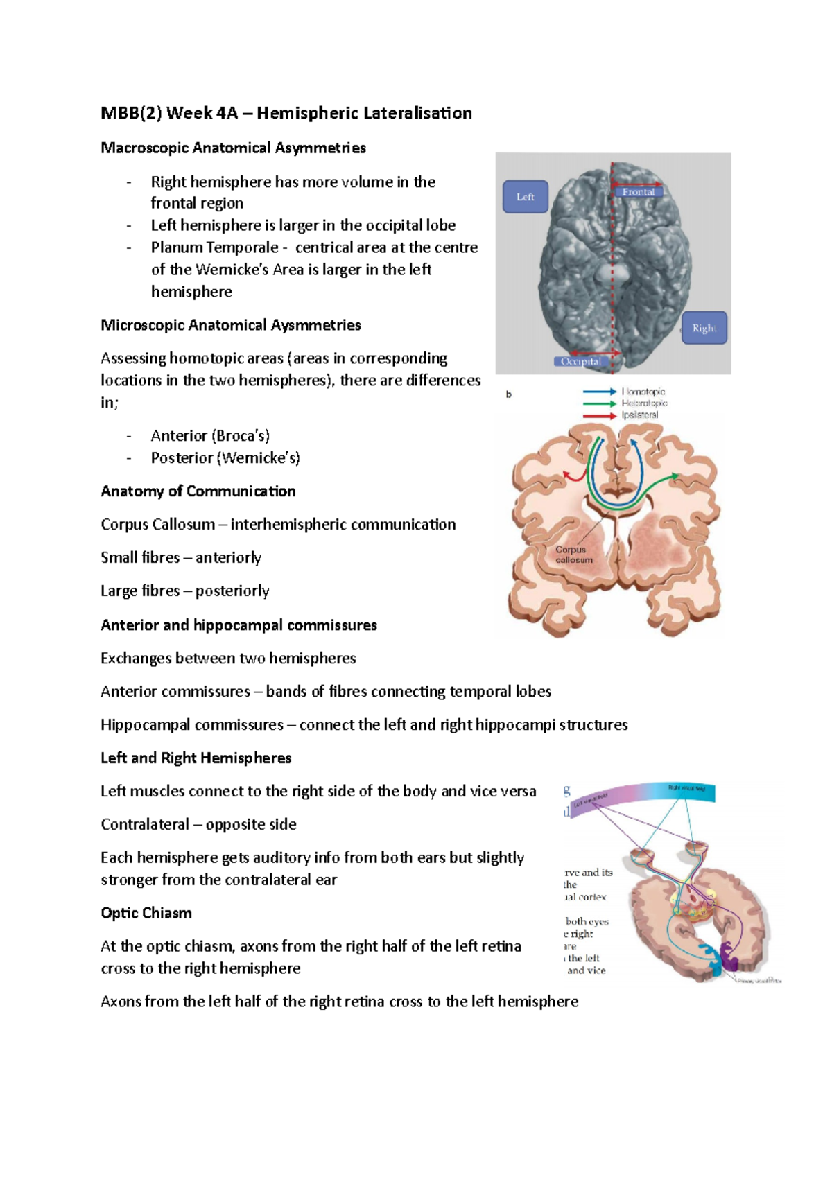 Hemispheric Lateralisation MBB(2) Week 4A Hemispheric