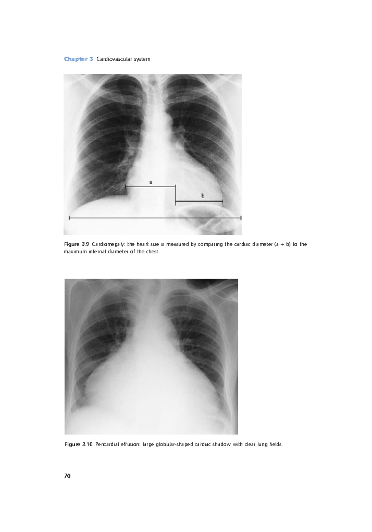 Radiology Lecture Notes pdf (24) - Chapter 3 Cardiovascular system 70 ...