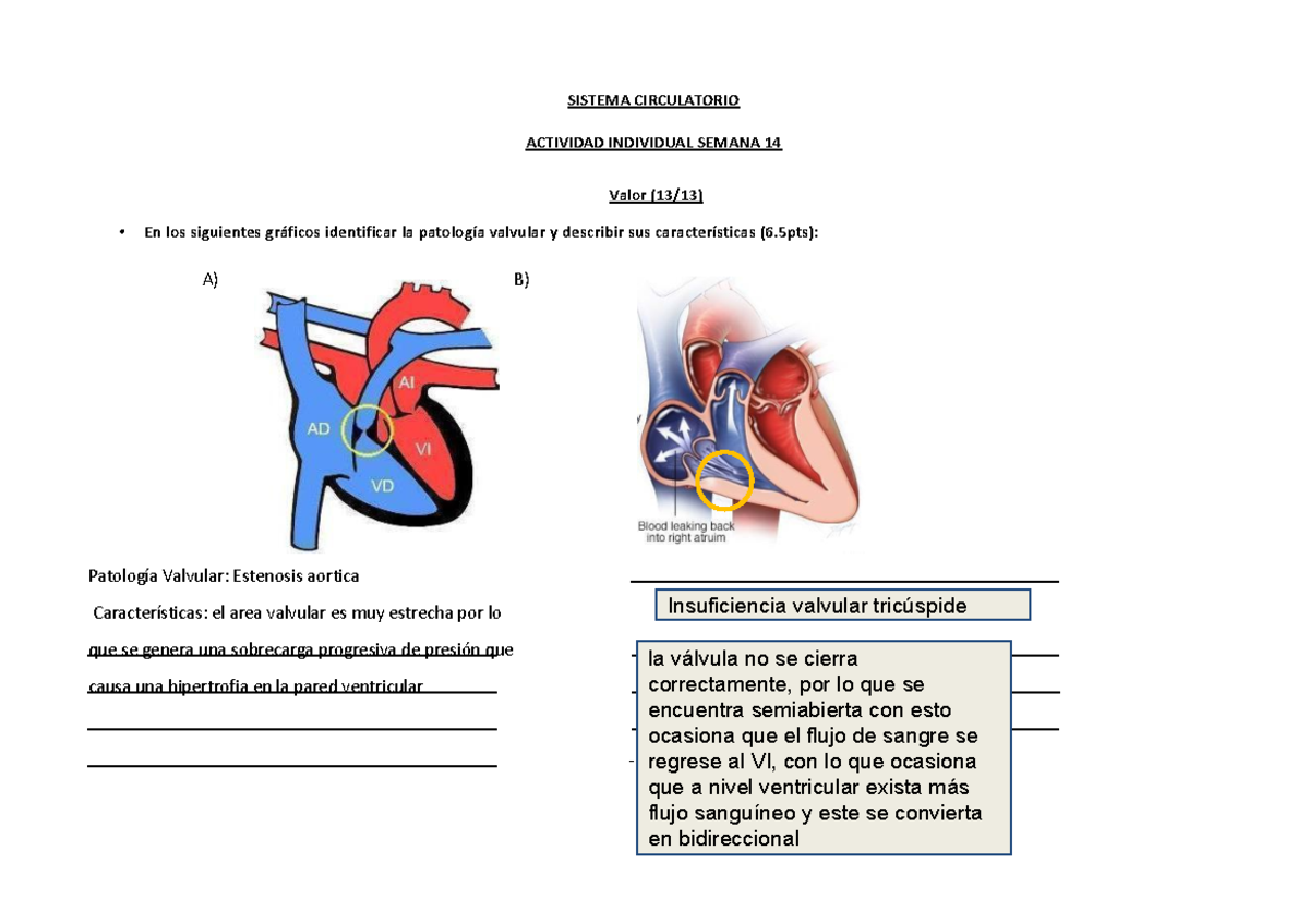 Tarea 14 SIST. Circulatorio NU Sem 14 - SISTEMA CIRCULATORIO ACTIVIDAD ...