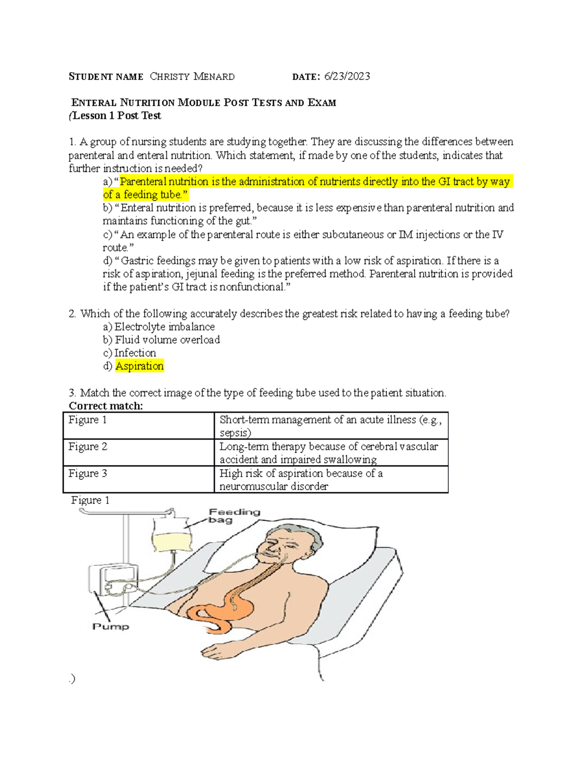 Enteral Feeding CM - STUDENT NAME CHRISTY MENARD DATE: 6/23/ ENTERAL ...