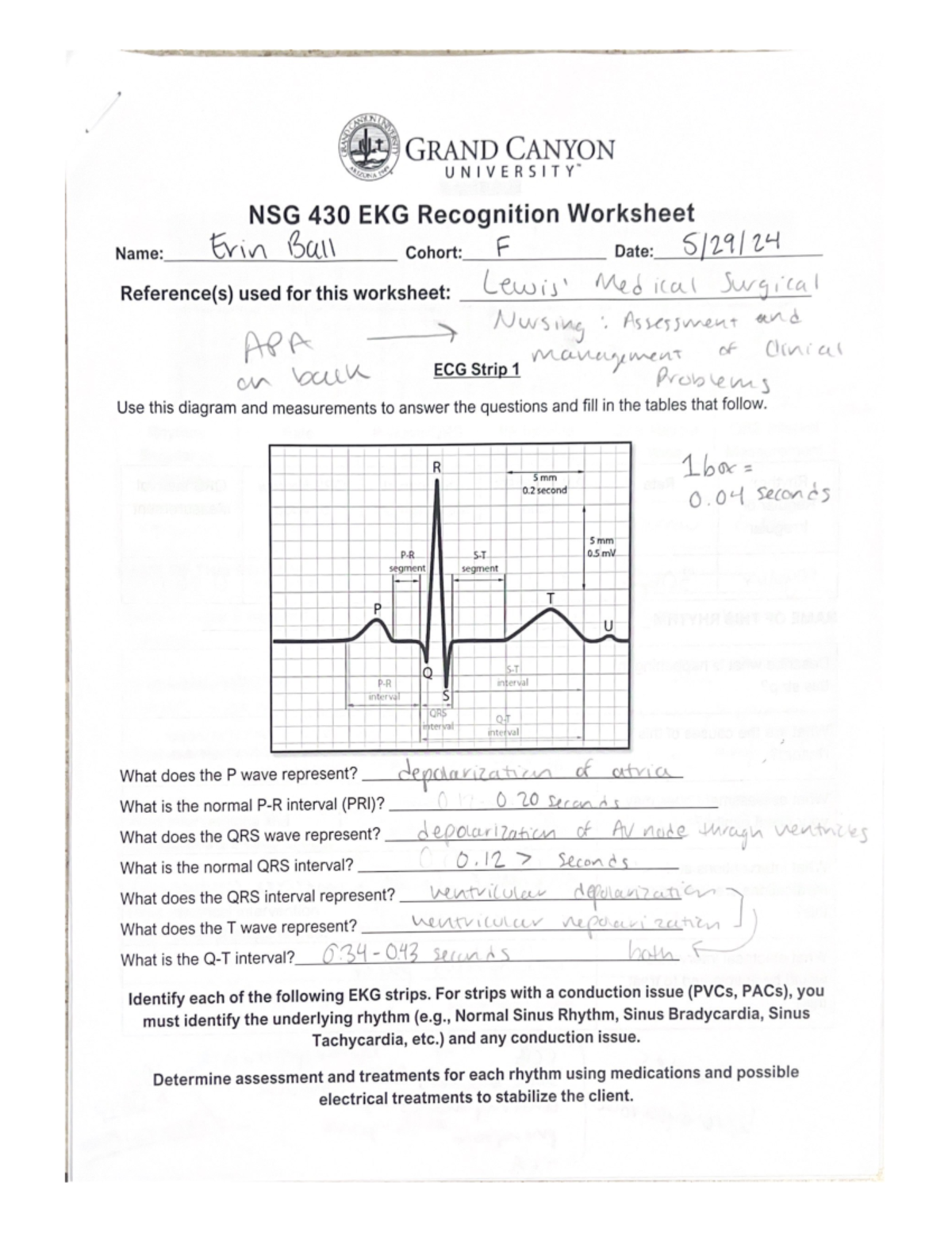 EKG worksheet - NSG-430 - Studocu