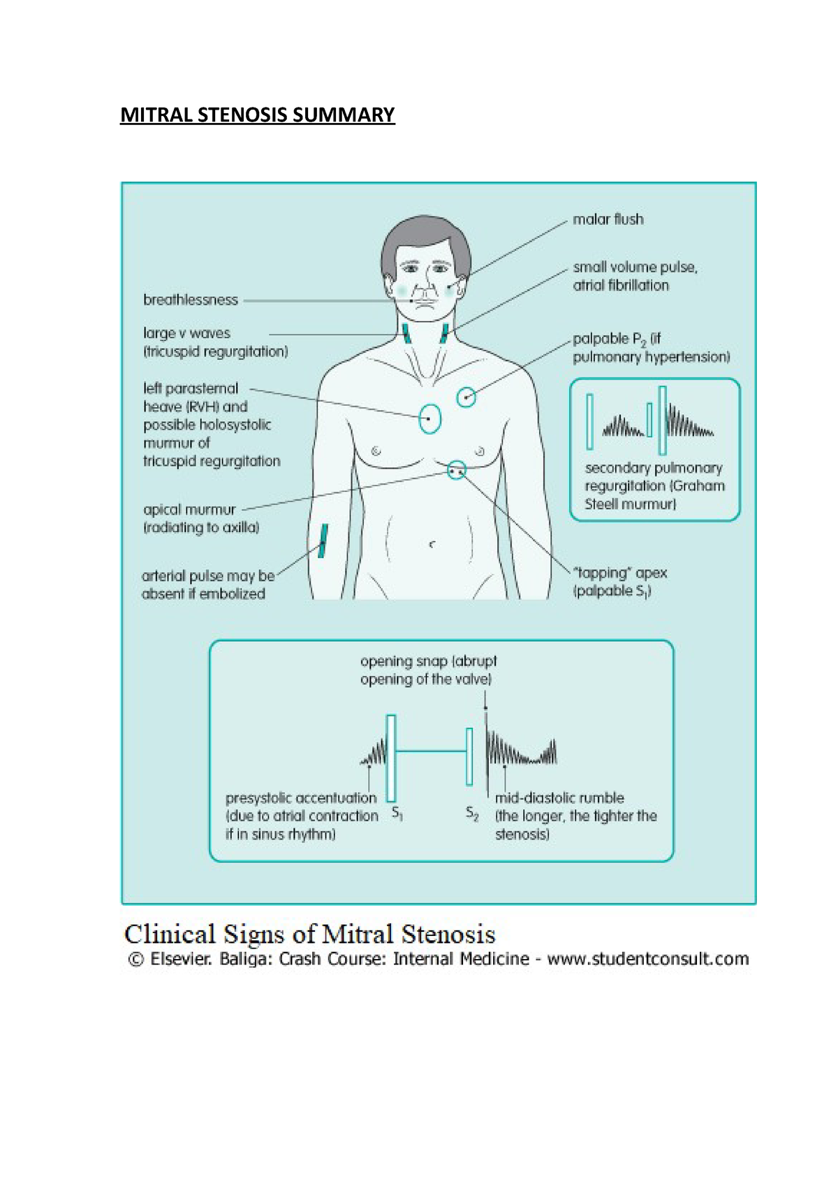 malar flush mitral stenosis