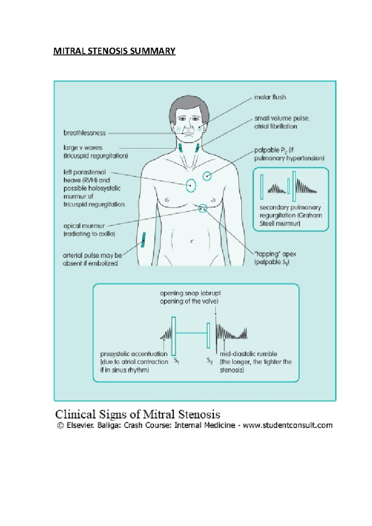 Malar Flush Mitral Stenosis