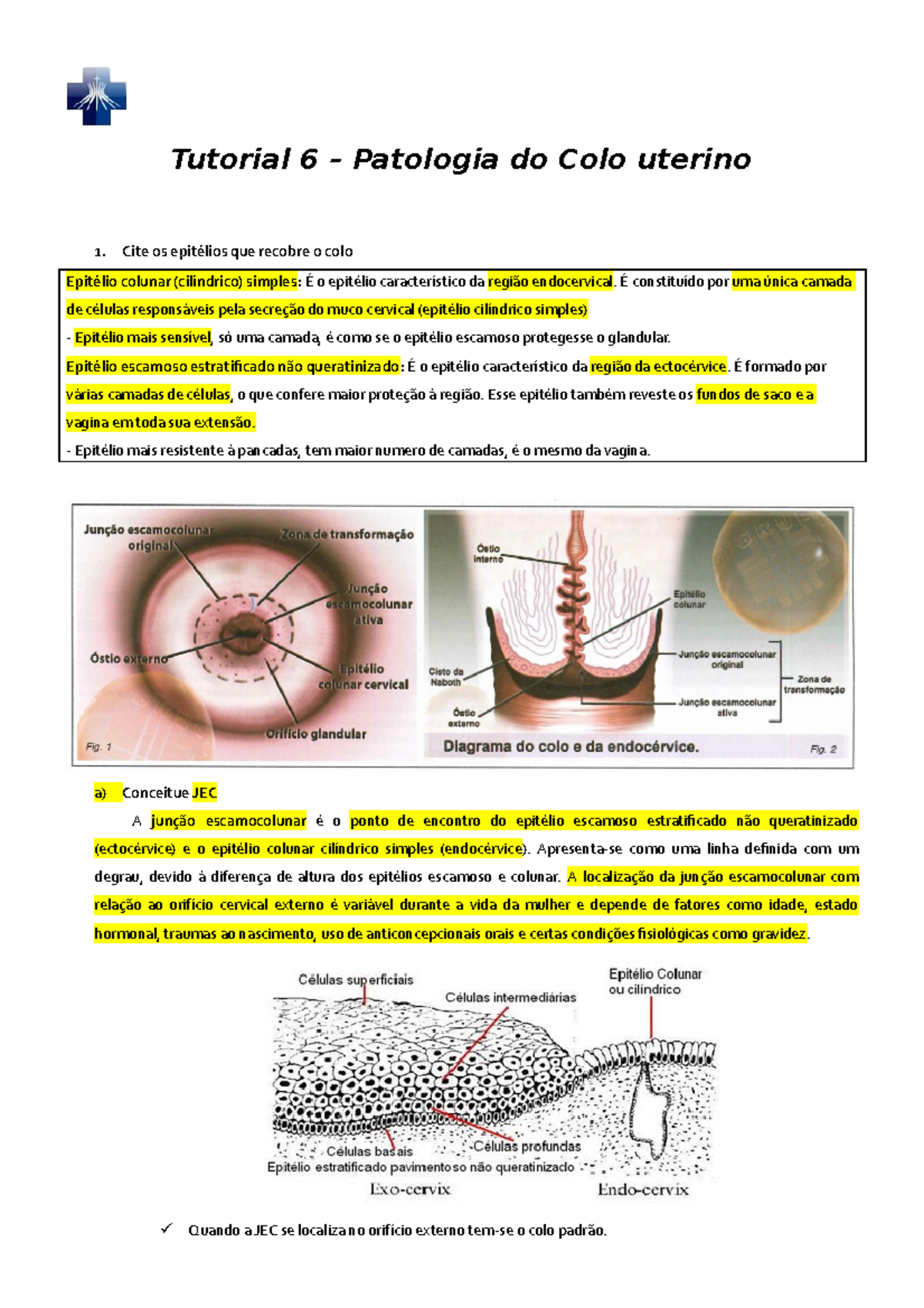 Tutorial 6 Patologia Do Colo Uterino Tutorial 6 Patologia Do Colo 