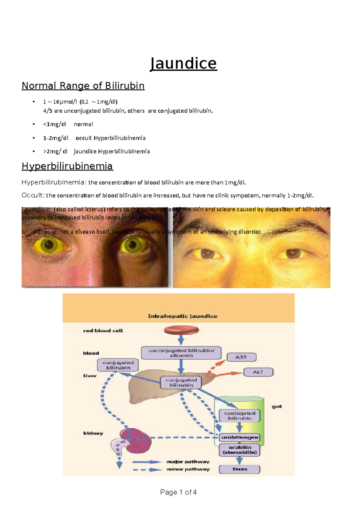 Chapter 23 Jaundice Jaundice Normal Range of Bilirubin 1 ～ 16 μmol