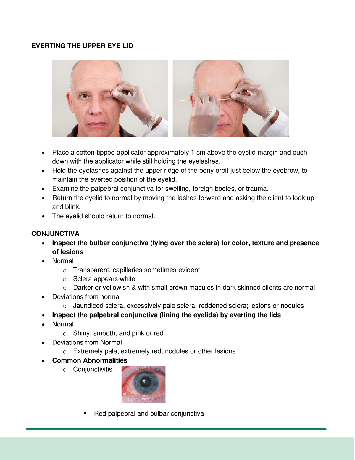 Everting THE Upper EYE LID - EVERTING THE UPPER EYE LID Place a cotton ...