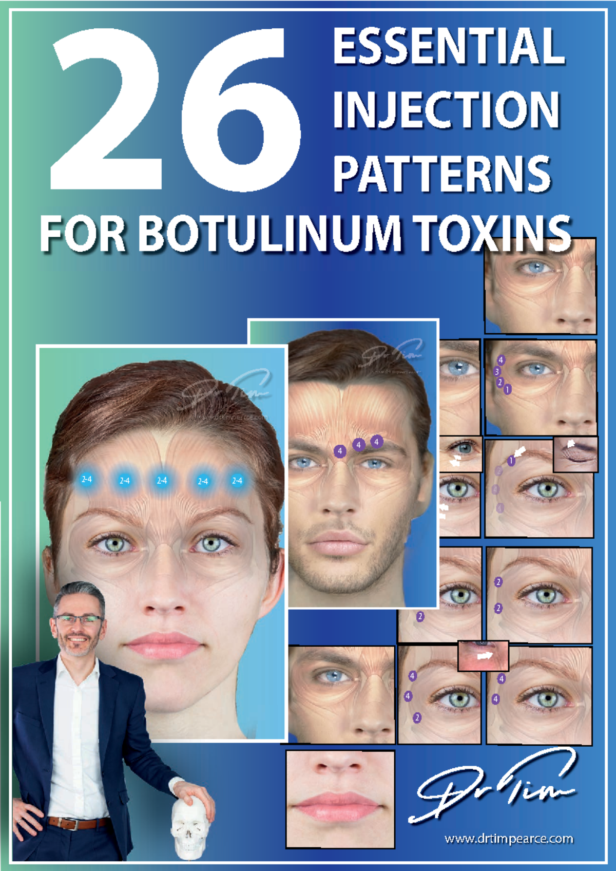 26 Essential Botox Injection Patterns - 4 2 2 2 4 4 4 4 4 2 4 3 2 1 2 2 ...