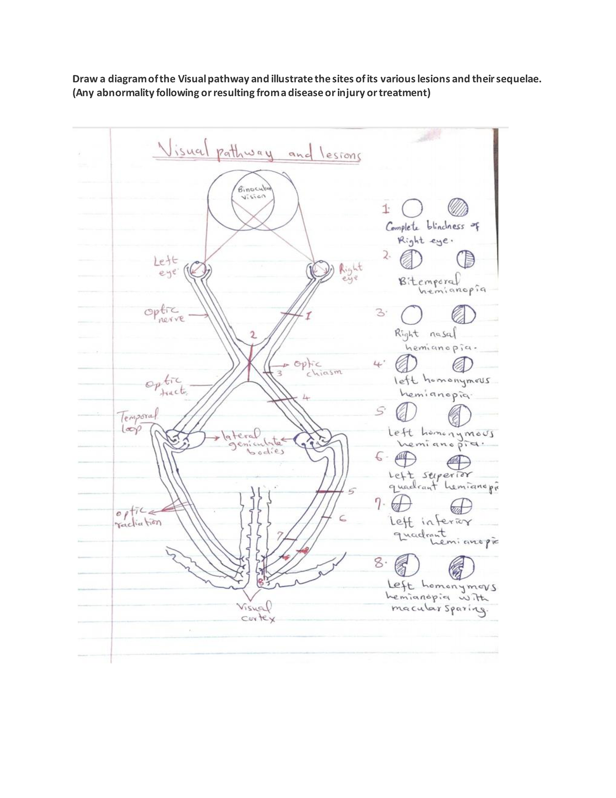 Anatomy assignment (Visual pathway) - Draw a diagram of the Visual ...