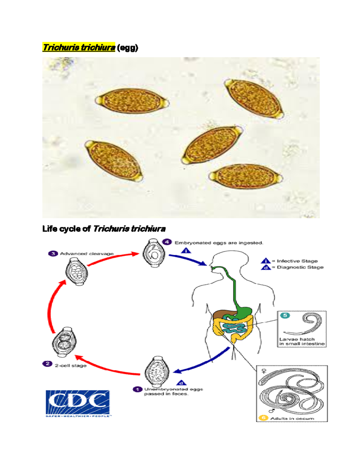 Intestinal Nematodes Trichuris Trichiura Egg Life Cycle Of Trichuris Trichiura Mot 2478