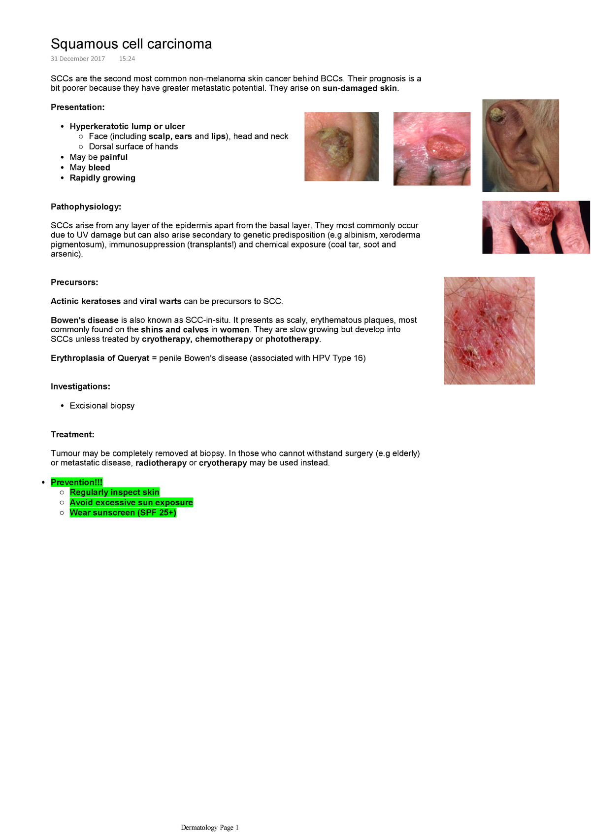 Disease summary: Squamous cell carcinoma - Warning: TT: undefined ...