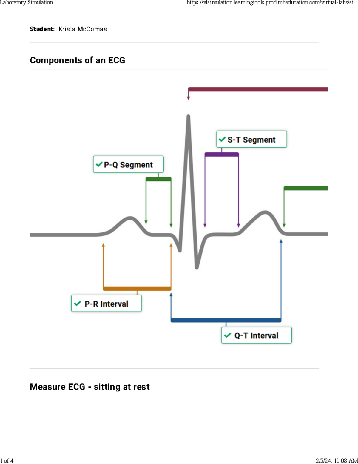 Ekg lab - . . - Student: Krista McComas Components of an ECG Measure ...