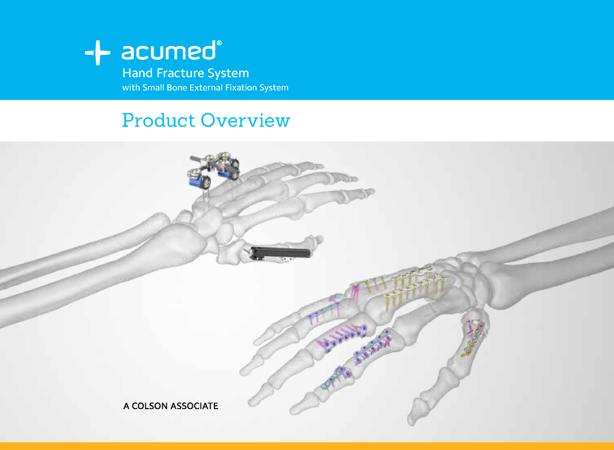 Hand Fracture System