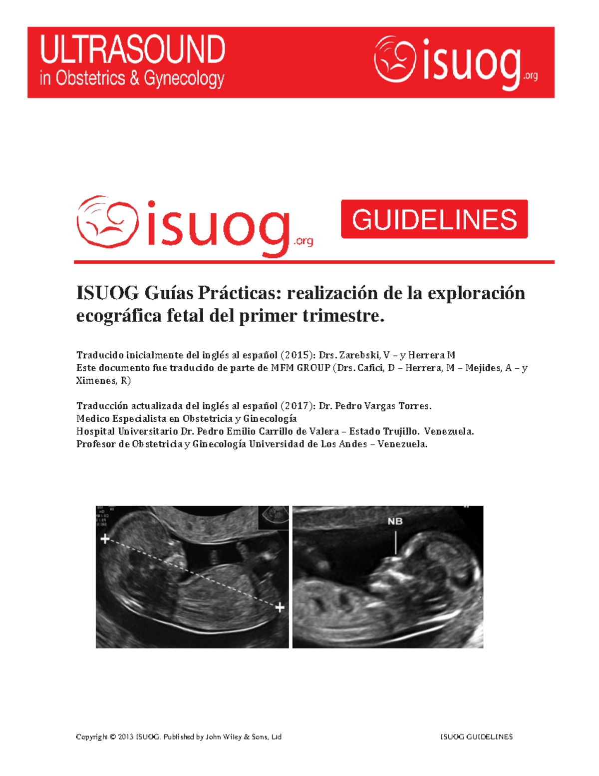 Ultrasonido Fetal Er Trimestre G Isuog Gu As Pr Cticas Realizaci N De La Exploraci N