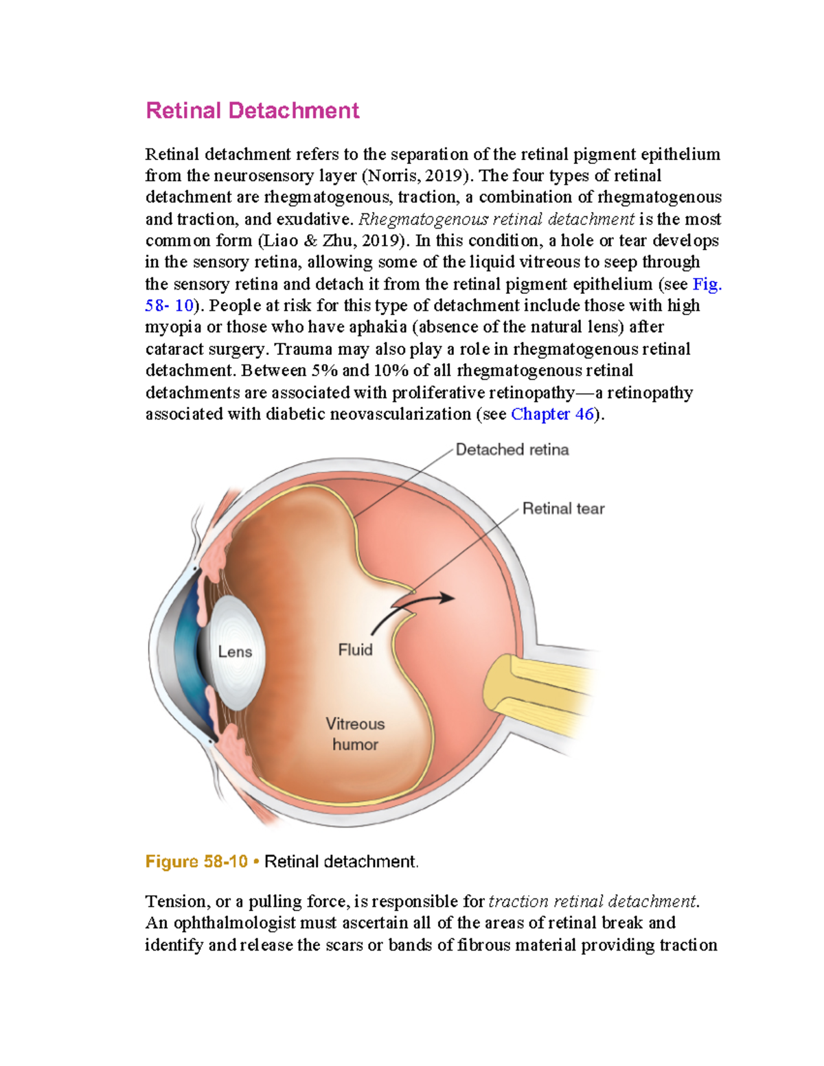 Retinal-Detachment - retinal detachment - Retinal Detachment Retinal ...