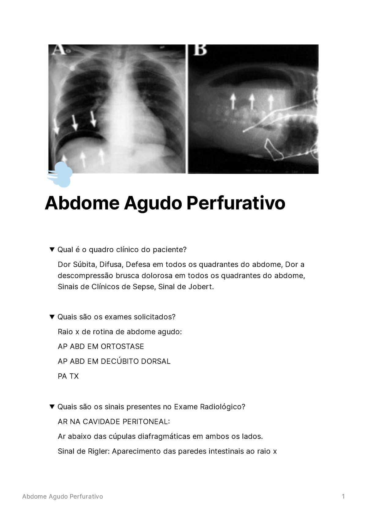 ABDOME AGUDO - Cirurgia Geral I