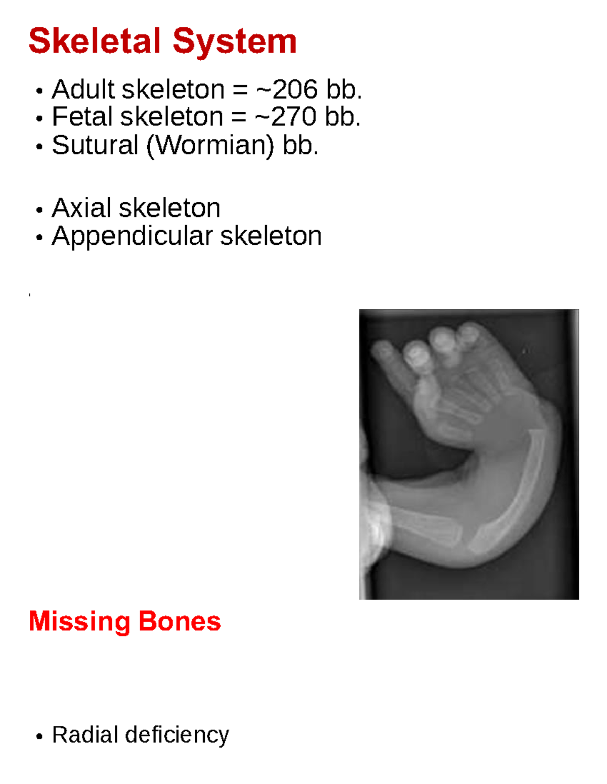 Skeletal System word - Skeletal System , Missing Bones Adult skeleton ...