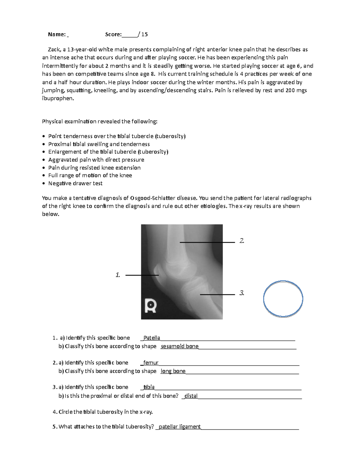 osgood-schlatter-case-study-1-name-score-15-zack-a-13-year