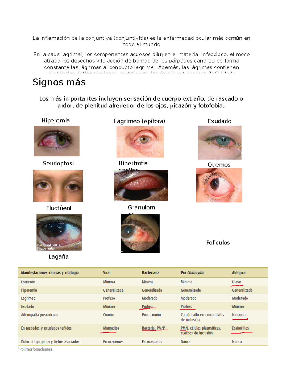 diferencia entre la conjuntivitis viral y bacteriana